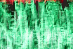 Green and red lines are seen in this image